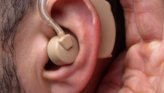 Ought to you obtain an over the counter listening to help?